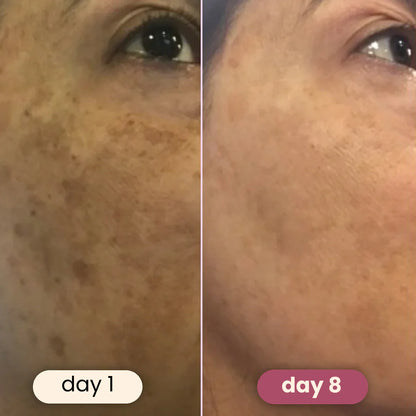 GlowBoost™ Turmeric Pads